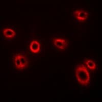 Polyclonal Rabbit anti-Human HLA-A Antibody (IHC, IF, WB)