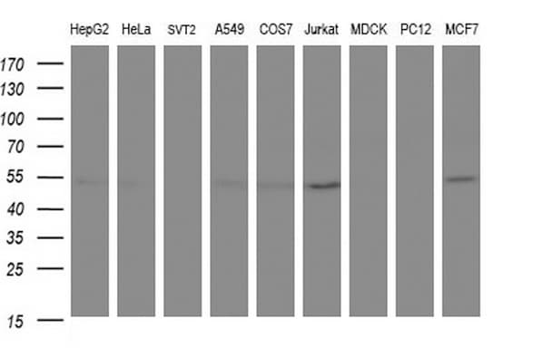 ANKMY2 Antibody (clone OTI1C12)