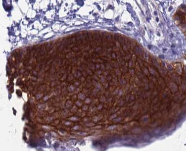 Polyclonal Rabbit anti-Human RBP5 Antibody (IHC, IF, WB)