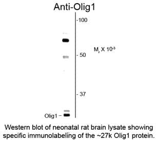 PathPlus™ Polyclonal Rabbit anti-Mouse OLIG1 Antibody (IHC, WB)
