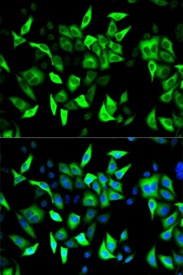 Polyclonal Rabbit anti-Human RRM2 Antibody (IHC, IF, WB)