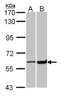 IHC-plus™ Polyclonal Rabbit anti-Human GPI Antibody (IHC, IF, WB)