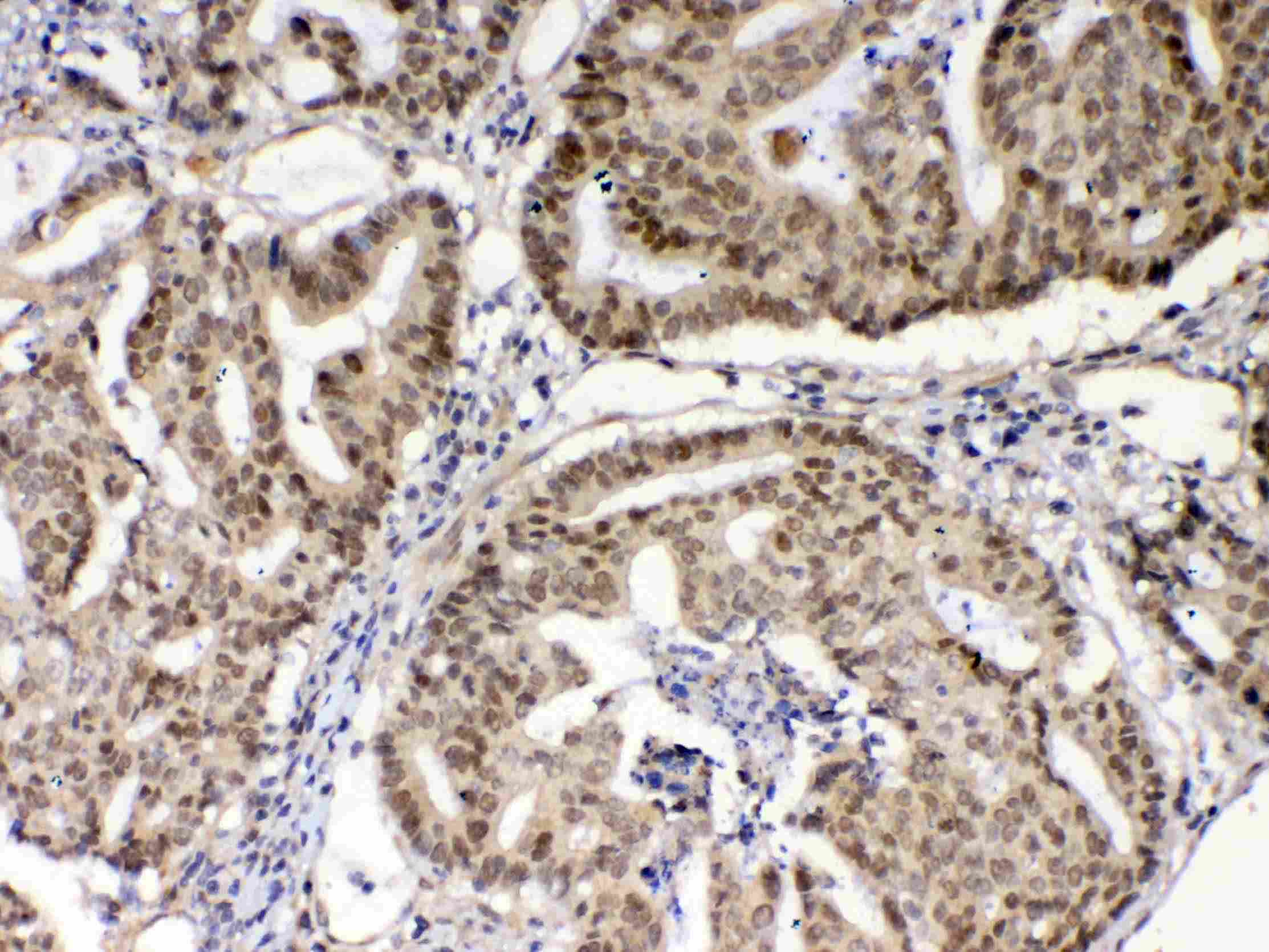 XRCC1 Antibody