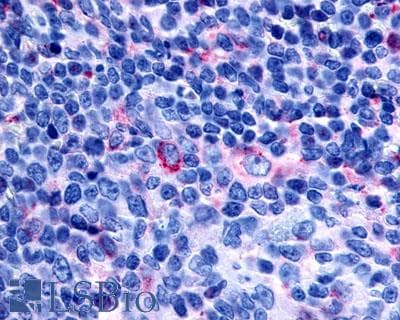 PathPlus™ Polyclonal Rabbit anti-Human GPR65 / TDAG8 Antibody (Cytoplasmic Domain, IHC)