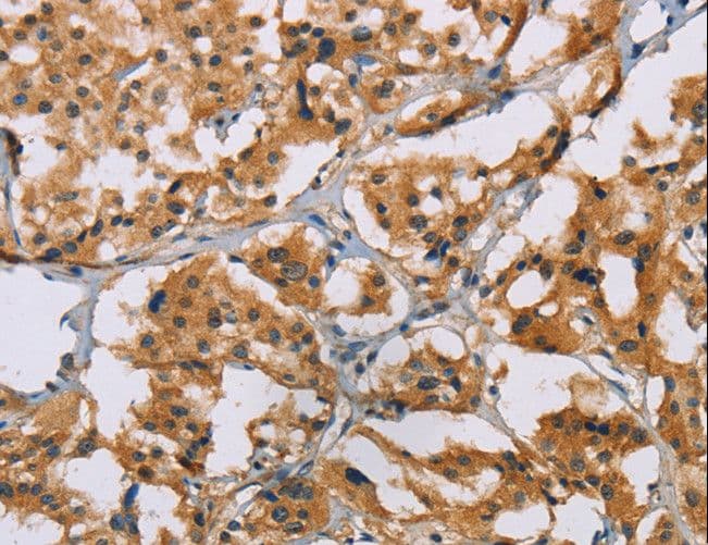 Polyclonal Rabbit anti-Human NRN1 / Neuritin Antibody (IHC)