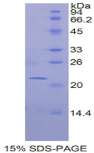 Mouse FBLN1 / Fibulin 1 Protein (Recombinant His)