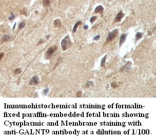 Polyclonal Rabbit anti-Human GALNT9 Antibody (IHC, WB)