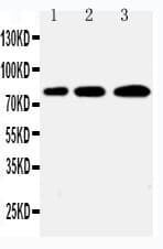 SNK / PLK2 Antibody (aa666-685)