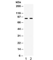 Polyclonal Rabbit anti-Human KIAA1524 / p90 Autoantigen Antibody (WB)