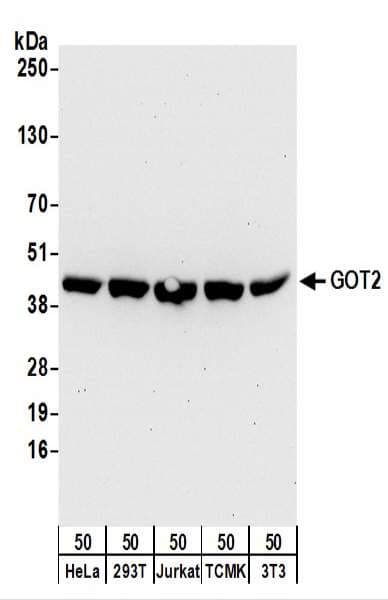 GOT2 Antibody (aa380-430)