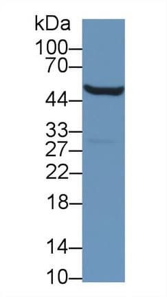 ALDH9A1 Antibody (aa322-494)