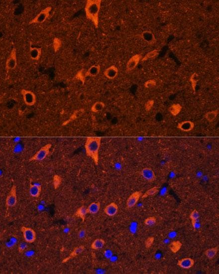 TUBB3 / Tubulin Beta 3 Antibody