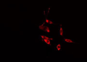RAB31 Antibody