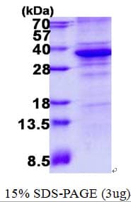 Human CDK5 Protein (Recombinant His)