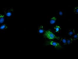 TCP11L2 Antibody (clone OTI1H7)