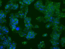 PFKFB4 Antibody (clone OTI1C8, Carrier-free)