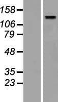 SALL4 Protein (Over-Expression Lysate Myc-DDK (Flag))