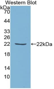 TIMP1 Antibody (aa25-207)