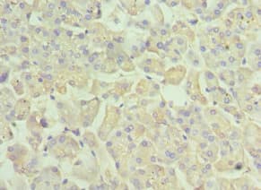 Polyclonal Rabbit anti-Human RAB4A / RAB4 Antibody (aa1-218, IHC)