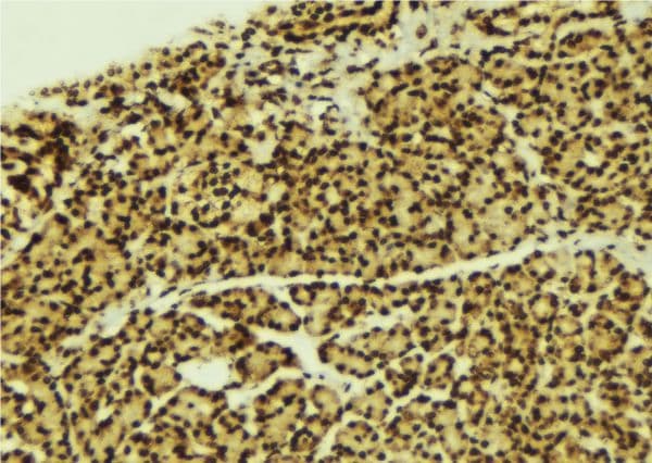 C/EBP Alpha / CEBPA Antibody