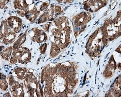 RIP1 / RALBP1 Antibody (clone OTI6E8)