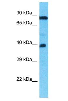 TMEFF1 / Tomoregulin 1 Antibody (aa1-50)