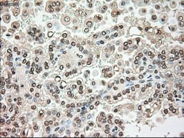 SERPINA1 / Alpha 1 Antitrypsin Antibody (clone OTI8E3)