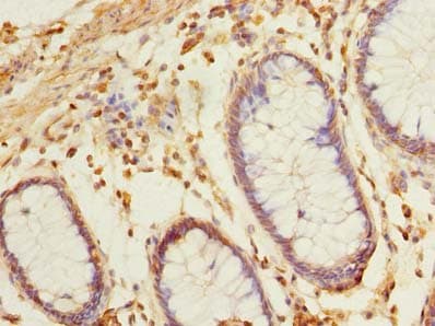 BRINP2 / FAM5B Antibody