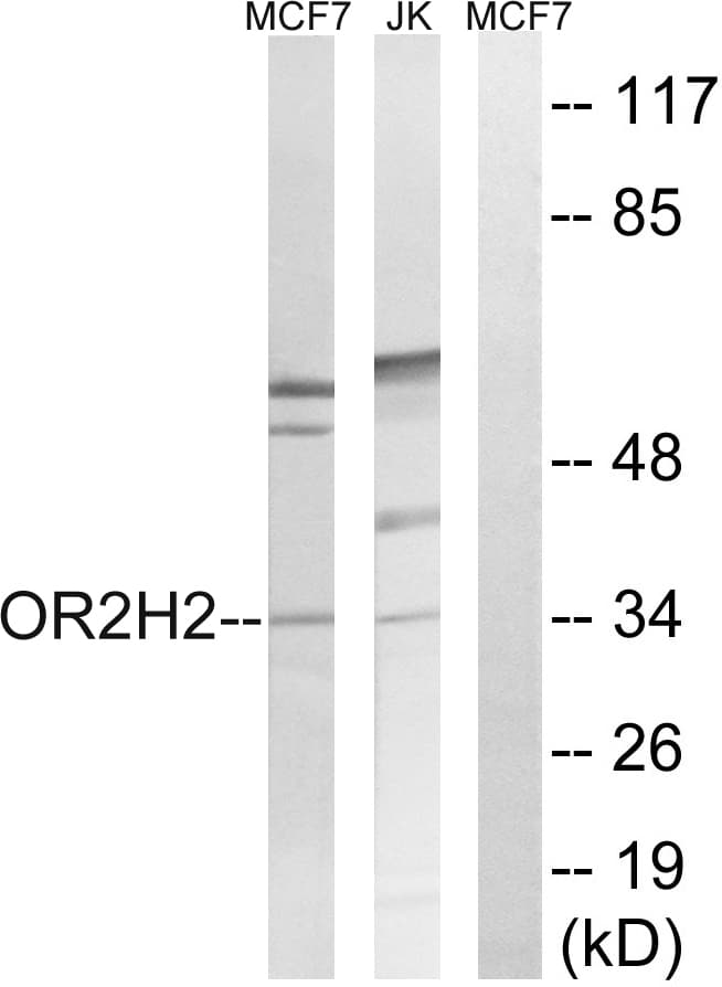 OR2H3 / OR2H2 Antibody (aa241-290)
