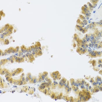 NMU / Neuromedin U Antibody
