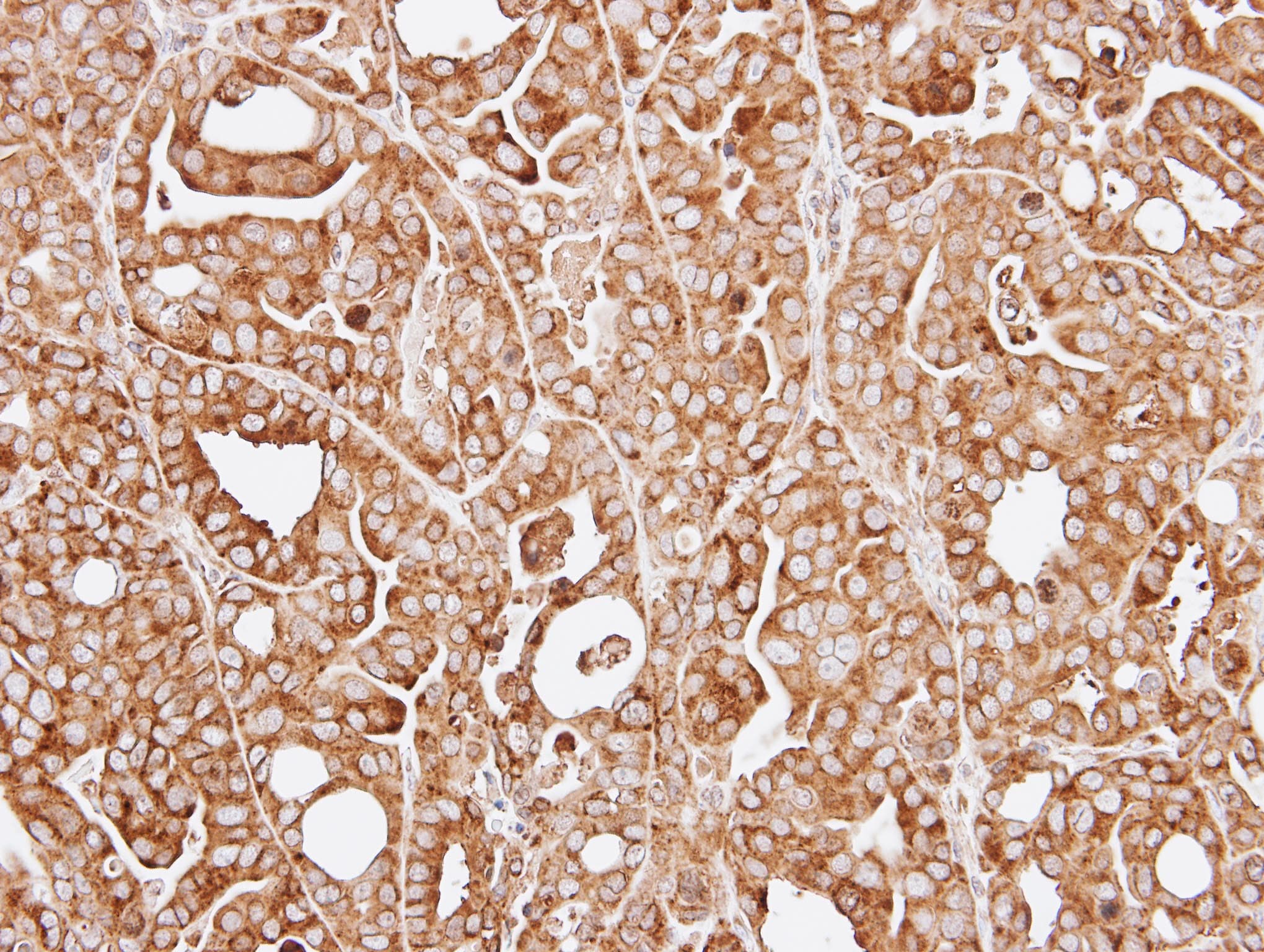 Polyclonal Rabbit anti-Human RPL13A Antibody (aa1-203, IHC, WB)