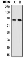 ELL / MEN Antibody (Internal)