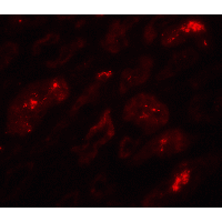 Polyclonal Rabbit anti-Human BATF3 Antibody (IHC, IF, WB)
