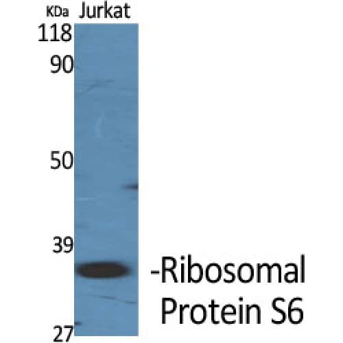 Polyclonal Rabbit anti-Human RPS6 / Ribosomal Protein S6 Antibody (180-260 aa, IHC, IF, WB)