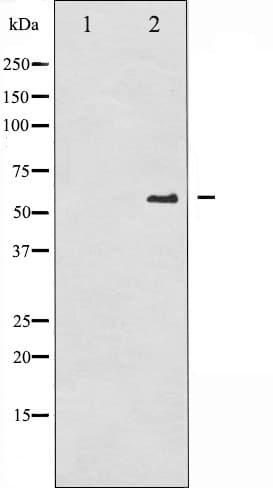 CDC25A Antibody (phospho-Ser75)