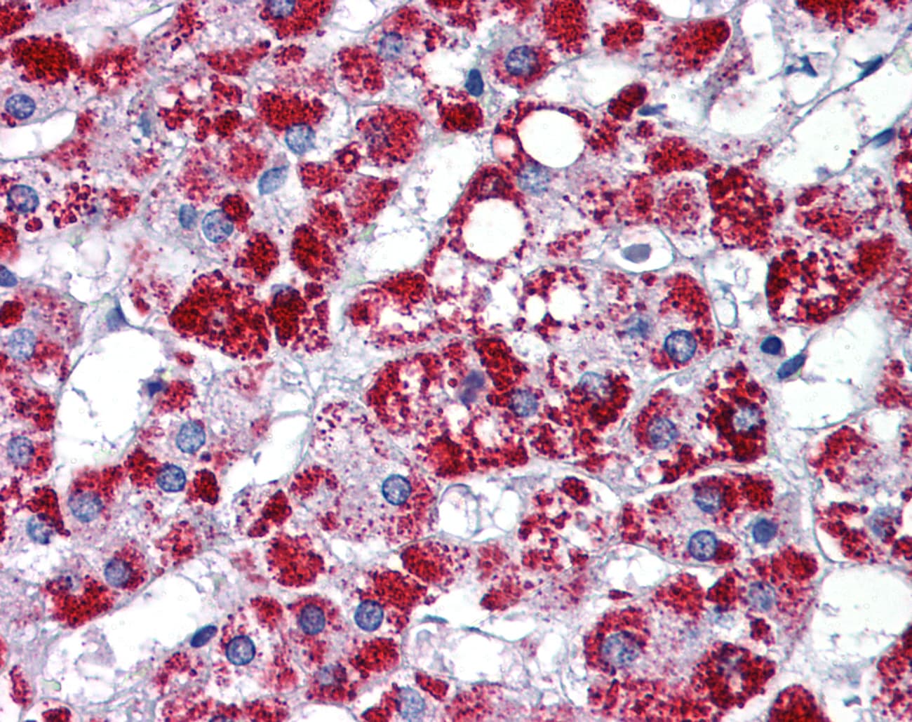 ARL8B Antibody (aa72-121)