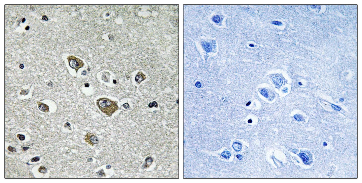 ZDHHC9 Antibody