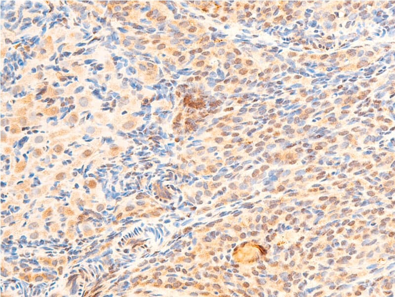 GSK3B / GSK3 Beta Antibody (phospho-Ser9)