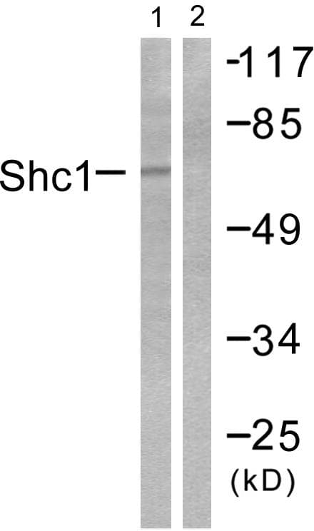 Polyclonal Rabbit anti-Human p66 / SHC Antibody (p427, IHC, WB)