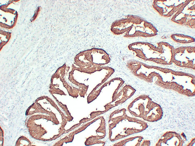 Monoclonal Mouse anti-Human ACPP / PAP Antibody (clone ABT-PSAP, IHC)