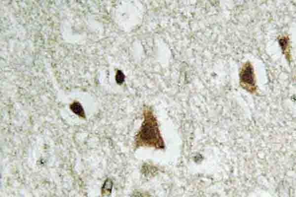 SMAD2 Antibody (Tyr216)