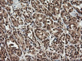 OTUB1 / OTU1 Antibody (clone OTI5F7)
