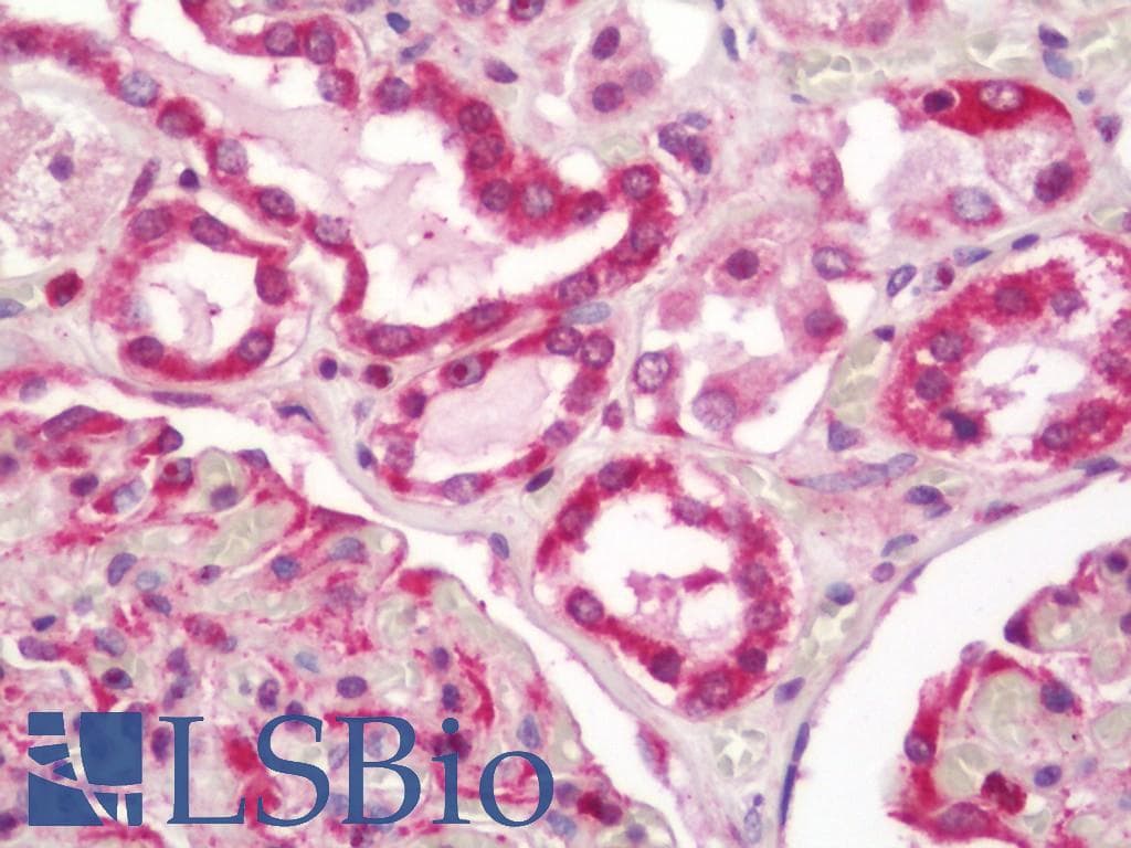 IHC-plus™ VAMP4 / VAMP-4 Antibody (aa1-50)