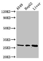 Polyclonal Rabbit anti-Human PSMA5 Antibody (IHC, WB)