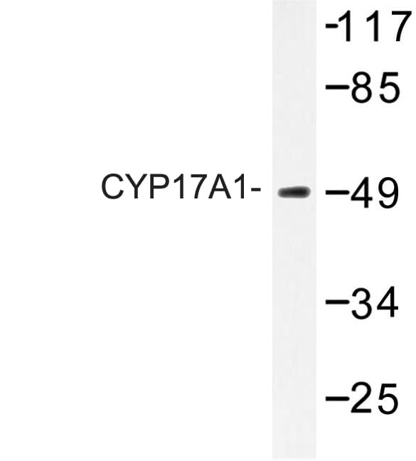 CYP17 / CYP17A1 Antibody (Asn249)