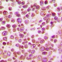 Polyclonal Rabbit anti-Human IRF4 Antibody (Internal, IHC, IF, WB)