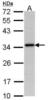 NAT1 / AAC1 Antibody