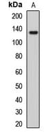 PALB2 Antibody
