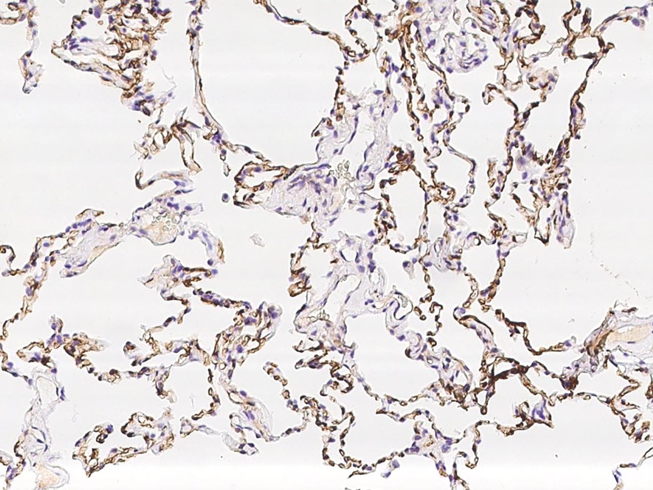 PRX / Periaxin Antibody
