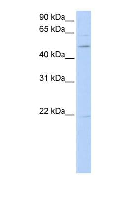 Polyclonal Rabbit anti-Human RORB / ROR Beta Antibody (C-Terminus, WB)